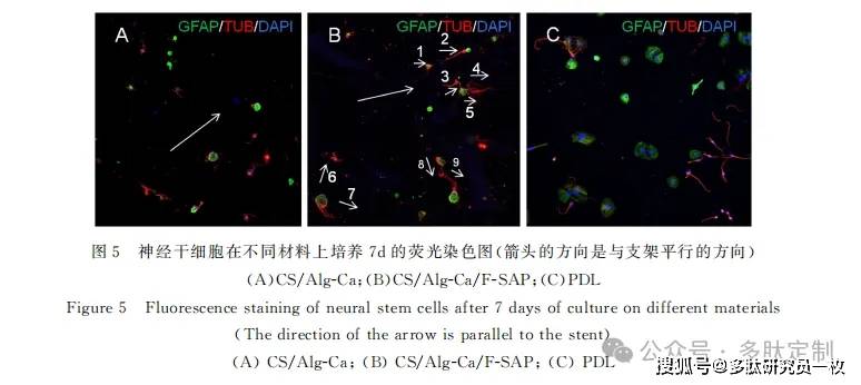 III 型胶原蛋白是调节关节软骨和半月板胶原纤维结构和生物力学的关键物质