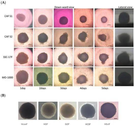 3D球体物理特性和细胞代谢特征可能是癌症相关成纤维细胞生物学性质决定性指标